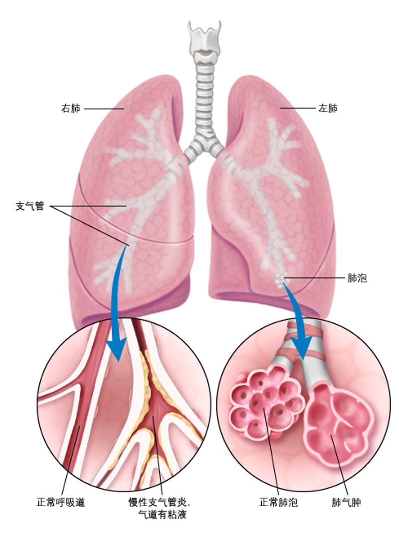 探索济南哮喘病医院:呼吸健康守护者